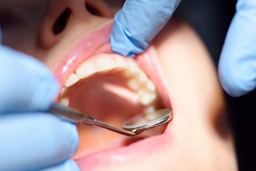 Goodbye Grinding, Hello Gentle: Getting a Cavity Fixed Without the Scary Sounds